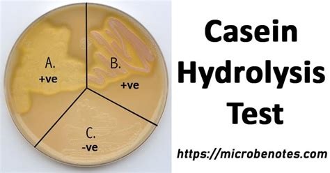 casein hydrolysis test|Casein Hydrolysis .